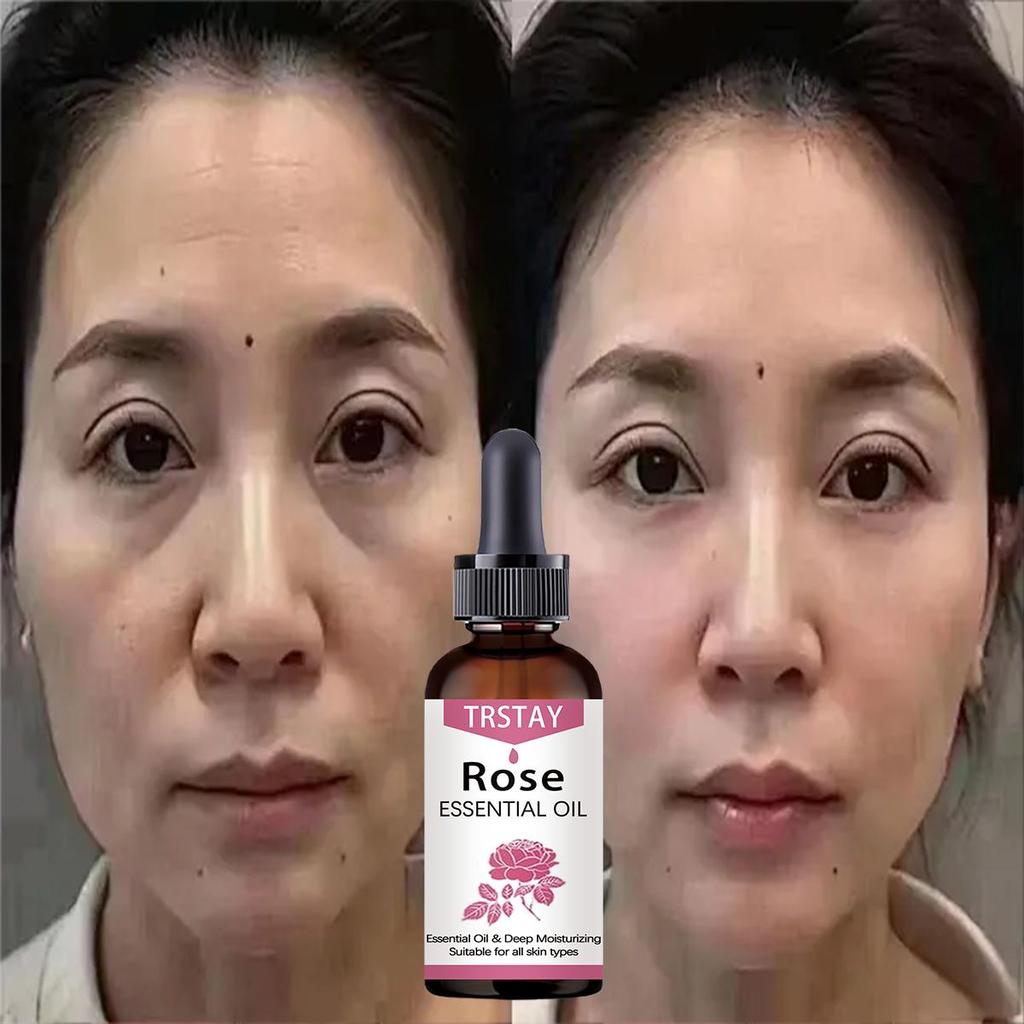 It Can Improve Skin Metabolism and Make the Skin Soft  Moisturize Dull and Dry Skin  Skin  Repair and Moisturize the Skin, Fade Blackness  Pigment,