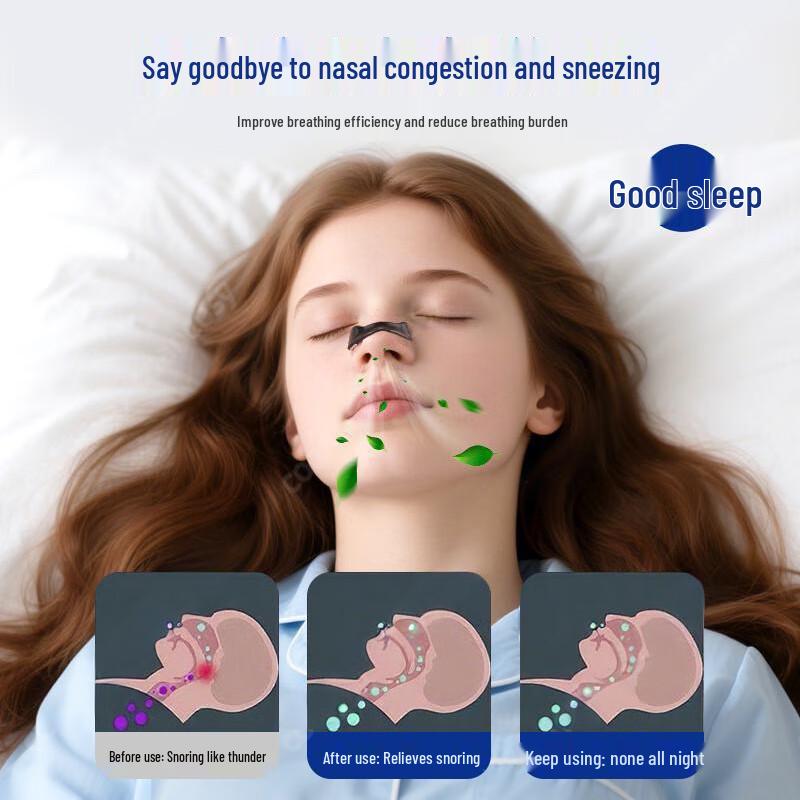 Jielangni Nasal Dilator Anti-Snoring Kit