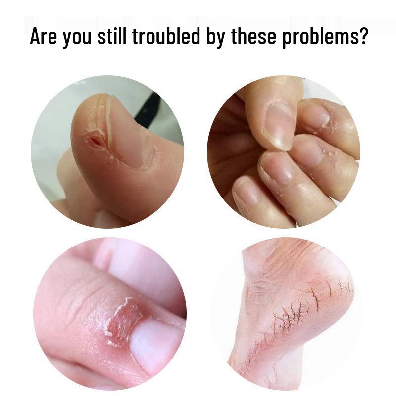 Vaseline Dry Skin Repair Stick for Hands & Feet - Anti-Crack, Breathable Adhesive Tape