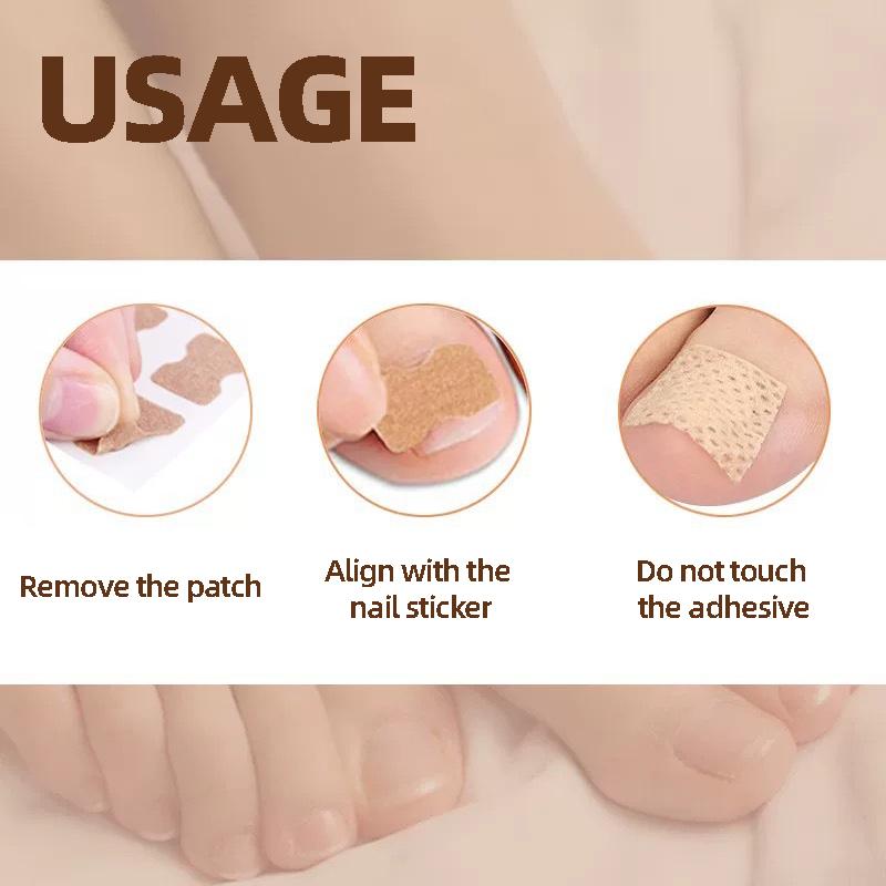 Nail Patch Ingrown Toenail Correction Nail Sticker Foot Pulling Patch Glue-Free Foot Sticker Nail Groove Ingrown Toenail Correction Nail Care Patches