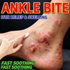 Natural Mosquito Bite Relief Balm, Soothes Itchy Skin & Bumps Fast