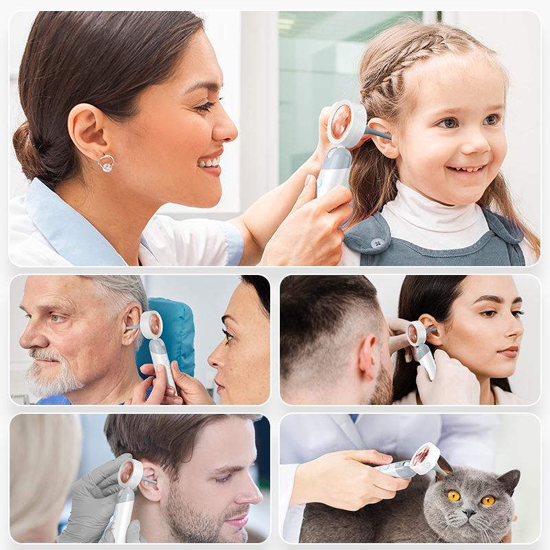 HD Smart Visual Otoscope for Ear, Nose, and Throat Examination