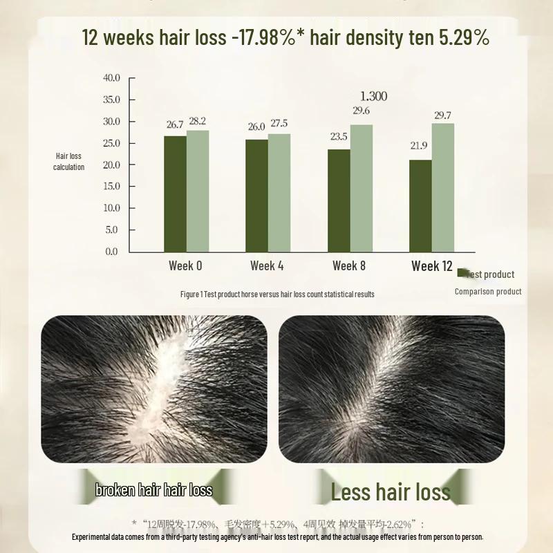 Bawang Anti-Hair Loss & Oil Control Shampoo