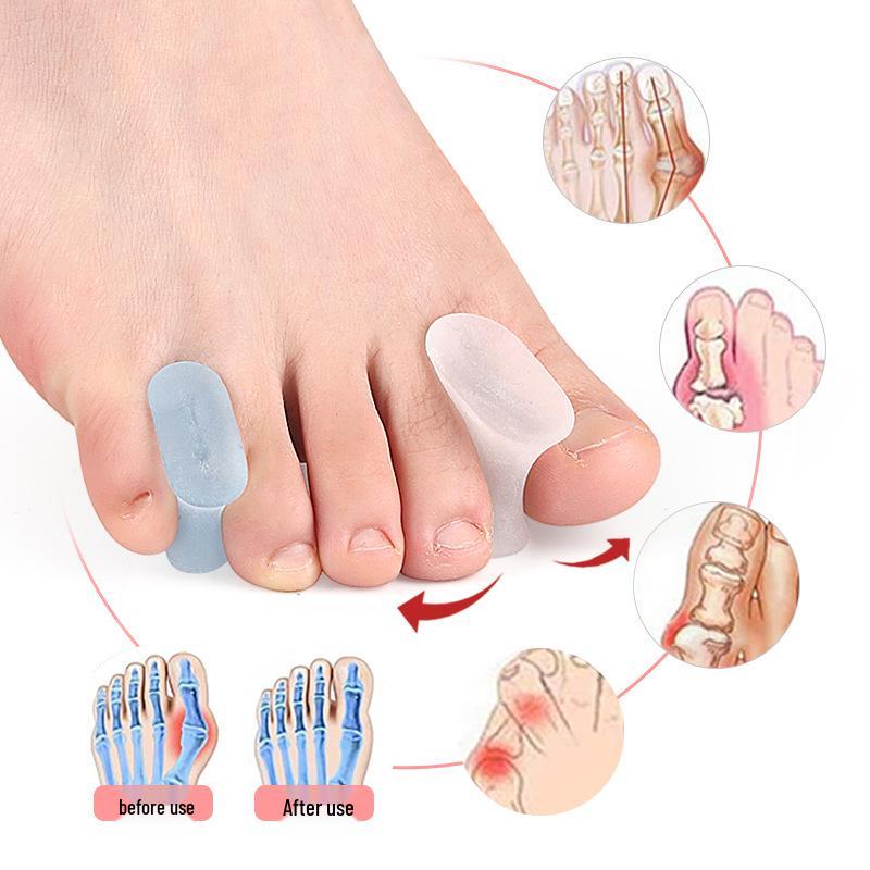 SEBS Soft Bunion Corrector & Toe Separator