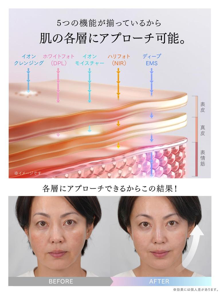 MYTREX MiRAY ONE Lift Care Facial Beauty Device White Photo DPL Hari Photo NIR Ion Moisture Deep EMS Ion Cleansing Home Use Beautiful Skin Whole Body