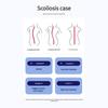 Scoliometer met Waterpasbel, Scoliosis Testmeter 0-30° voor Beoordeling van de Wervelkolomuitlijning en Ondersteuning van de Wervelkolomgezondheid