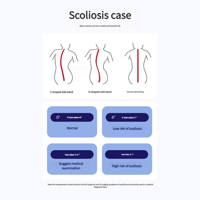 Scoliometer met Waterpasbel, Scoliosis Testmeter 0-30° voor Beoordeling van de Wervelkolomuitlijning en Ondersteuning van de Wervelkolomgezondheid