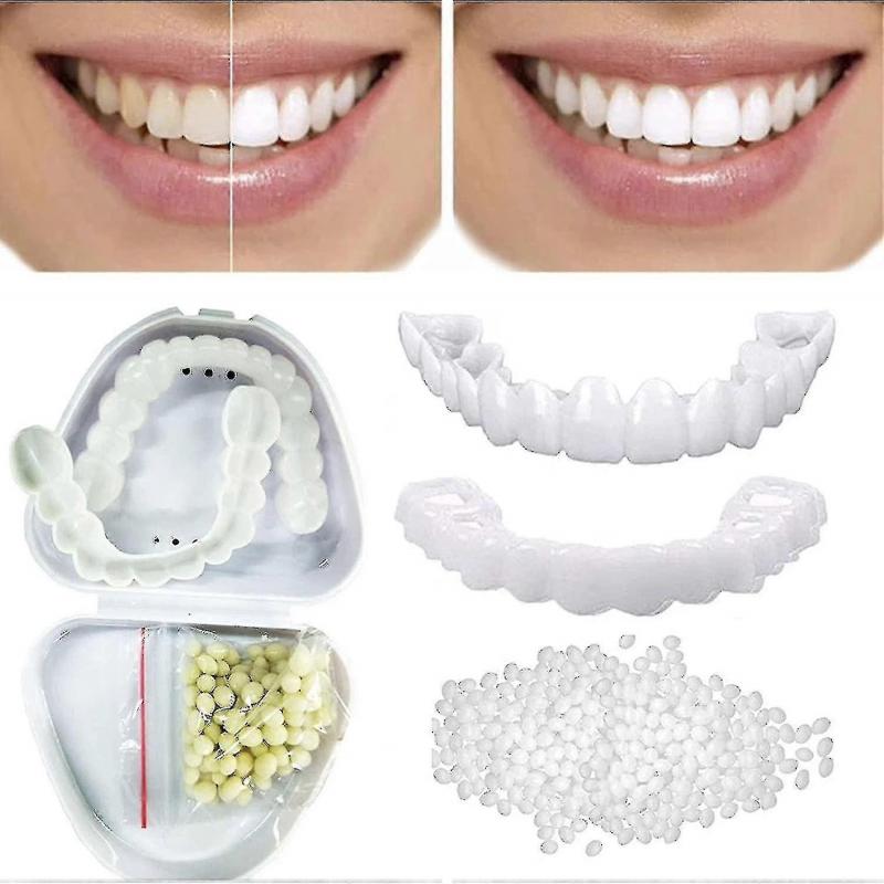 Upper & Lower Teeth Veneers - 2 Pairs Simulation Braces Sp On Veneers Smile Fake Teeth Cover Imperfect Teeth Perfect Whitening False Teeth One Size De