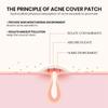 Multi-color Star Acne Patches, Facial Acne Patches, Concealer Acne Patches, and Pimples Patches, Ultra-thin