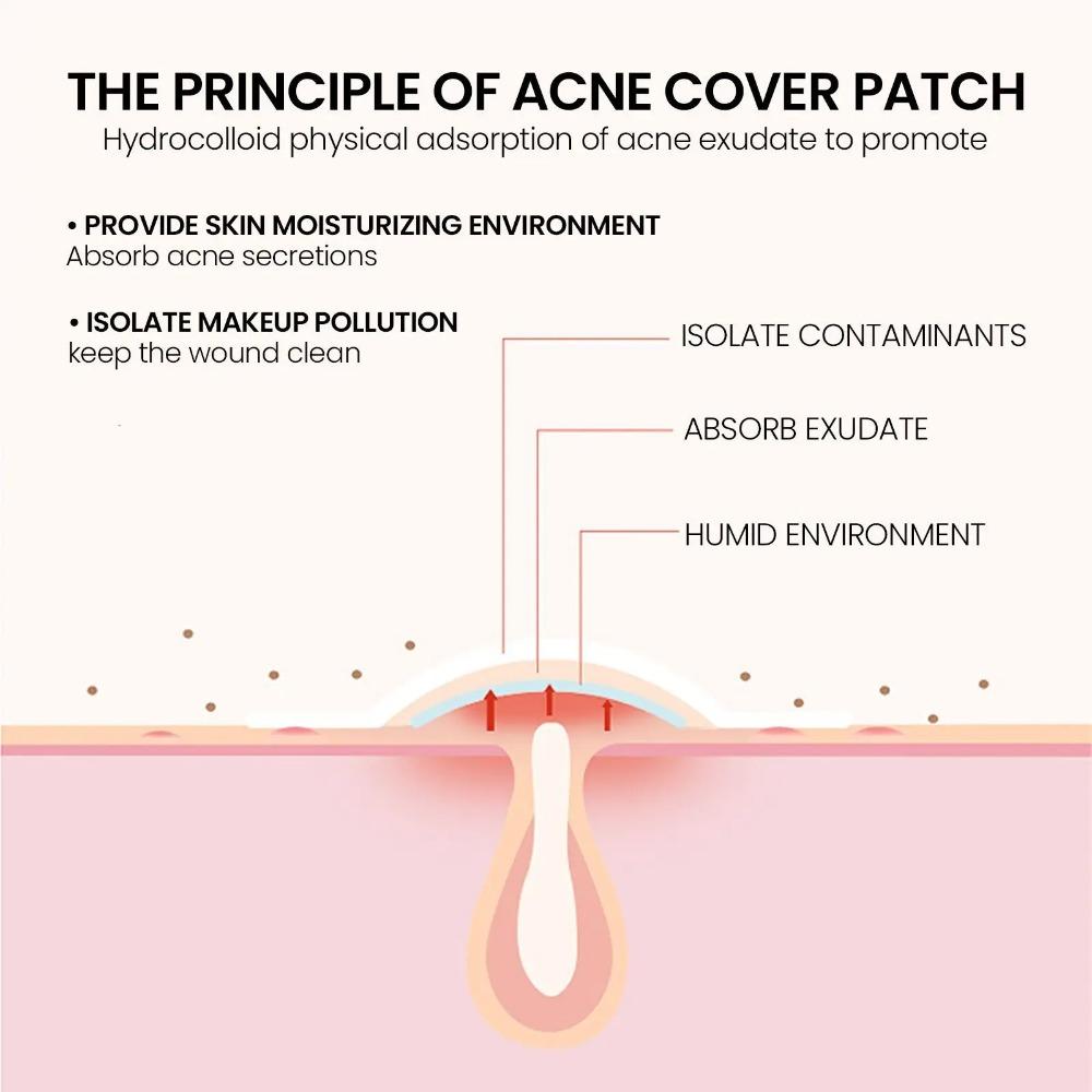 Multi-color Star Acne Patches, Facial Acne Patches, Concealer Acne Patches, and Pimples Patches, Ultra-thin