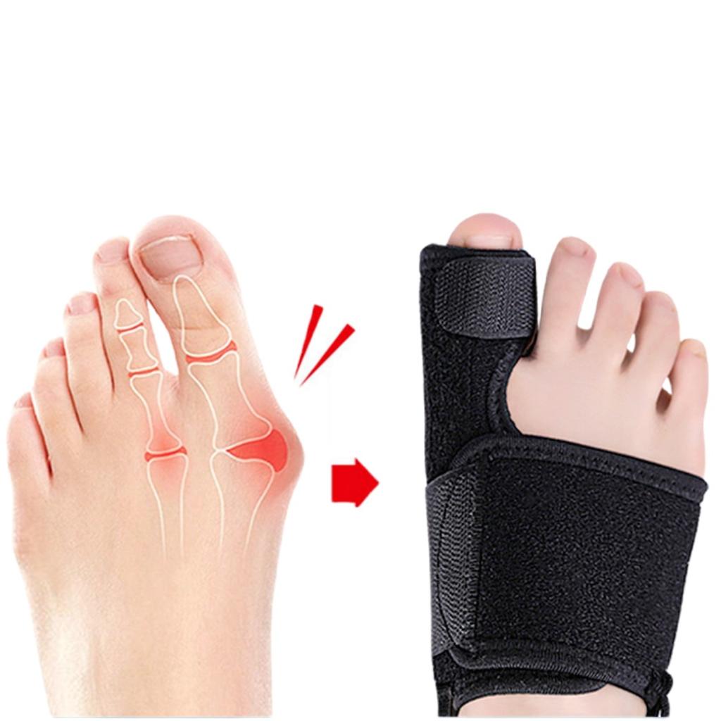 Adjustable Hallux Valgus Bunion Splint Big Toe Straightener Orthosis Foot Protector Pain Relief Toe Separator