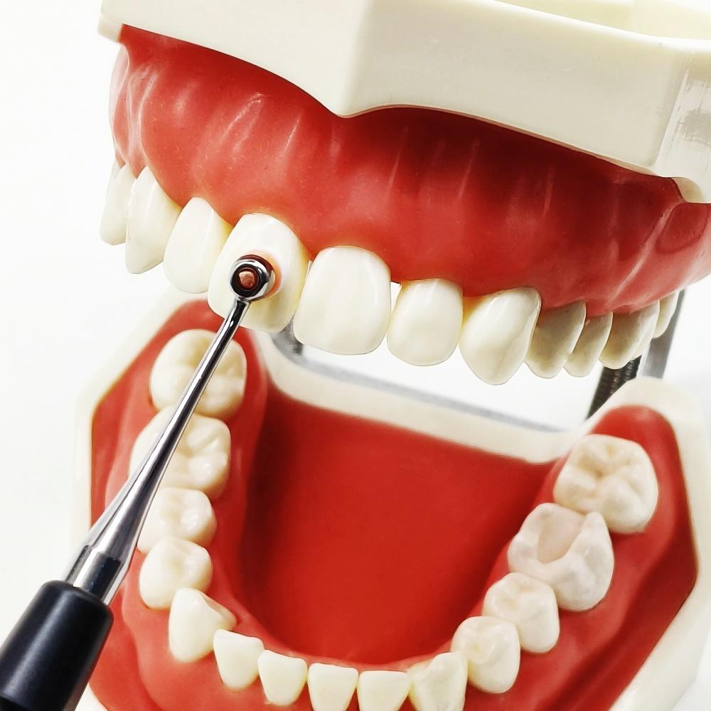 Dental Composite Resin Filling Spatula Assortment Kit Tool Sculpt Pads Mixing Handle Foam Pads L/S Modeling Instrument