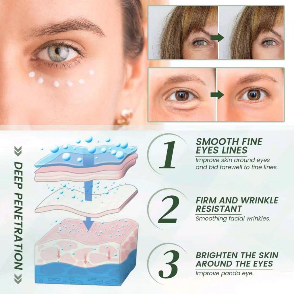 Aufhellende Creme zum Entfernen dunkler Flecken, Gesichtscreme gegen Sommersprossen, Creme zum Entfernen von Melasma und dunklen Flecken, aufhellende Creme zum Entferner