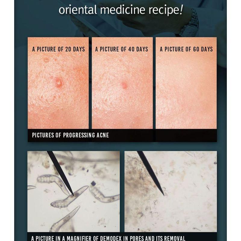 Pyunkang Yul Akne-Gesichtsreiniger 120 ml