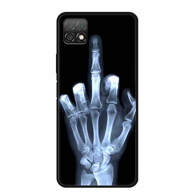For Wiko T3 Case Popular Image Pictures Black Silicone Soft Back Cover Case For Wiko T3 Phone Case Cover T 3 Funda Coque Shell