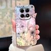 Case For Xiaomi Redmi Note15 15 Pro 15Pro+ Lovely Whale Kitten Camera Protection Soft Shell For Redmi Note 15 Pro Plus Protector