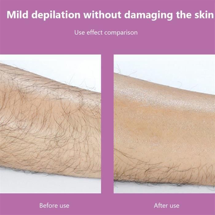 Black - Épilation Physique Cristal Épilateur Gomme Sécurité Épilateur Réutilisable Facile À Nettoyer Corps Be