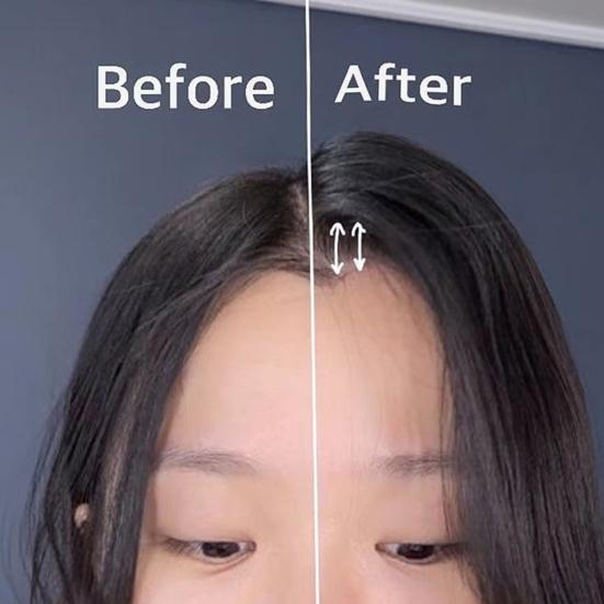 2Pcs Fluffy Hair Brush Clip Natural Bump Up Comb Volume Clip Portable Travel Forehead Bangs Styling Comb Women Girls Hair Accessories