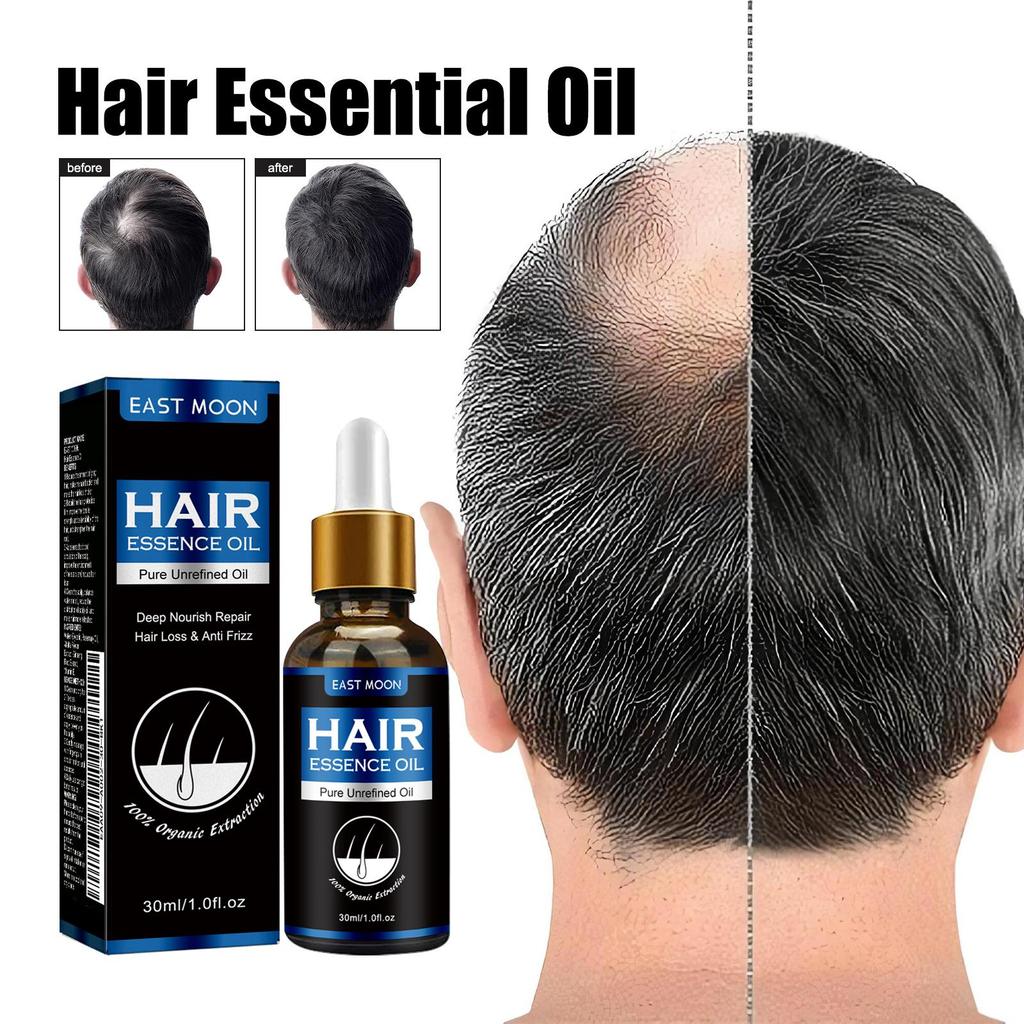 East Moon Haarwachstumsserum für Männer 30ml - Gegen Haarausfall, Stärkt das Haar, Fördert das Haarwachstum, Feuchtigkeitsspendende Haarkur