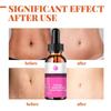 5ML/15ML/30ML/50ML/Mild Without Irritation Stretch Mark Spray Repair Removal Acne Scar Stretch Marks Cream Fat Scar Striae Gravidarum