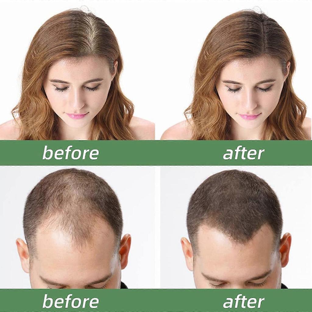 2 Pack Batana Oil for Hair Growth - Promotes Healthy Hair for Men & Women, Enhances Hair & Skin