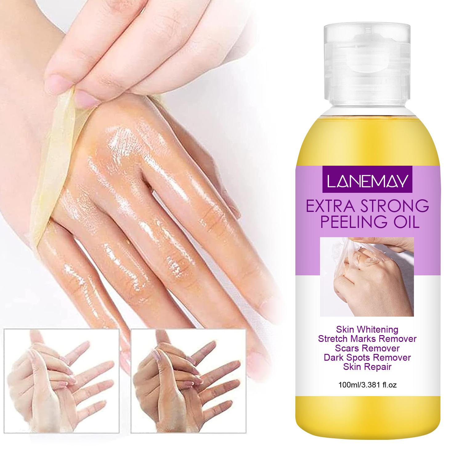 

Очень сильный пилинг-масло-Отбеливание и восстановление кожи-Удаление растяжек и шрамов-Подходит для всех типов кожи, 100 мл