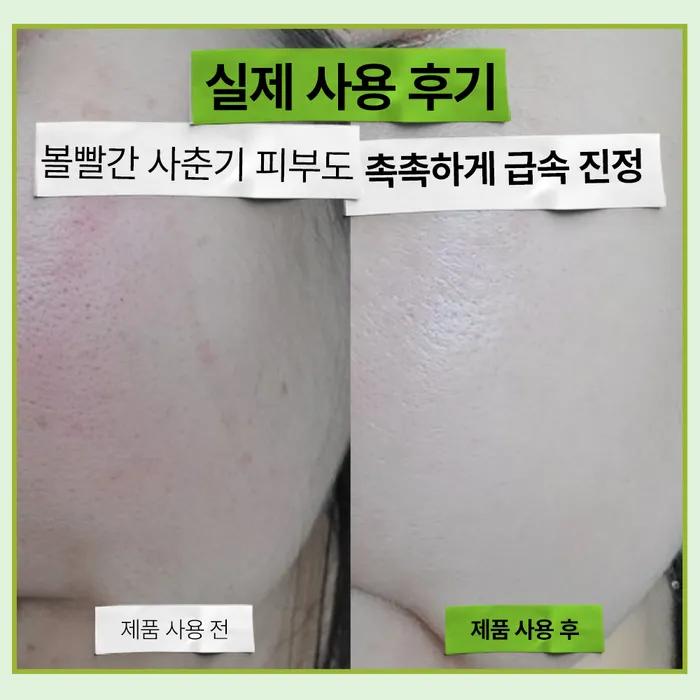 [x2 speed soothing]_Artichoke Hyaluronic Acid Moisturizing Soothing Ampoule 50ml
