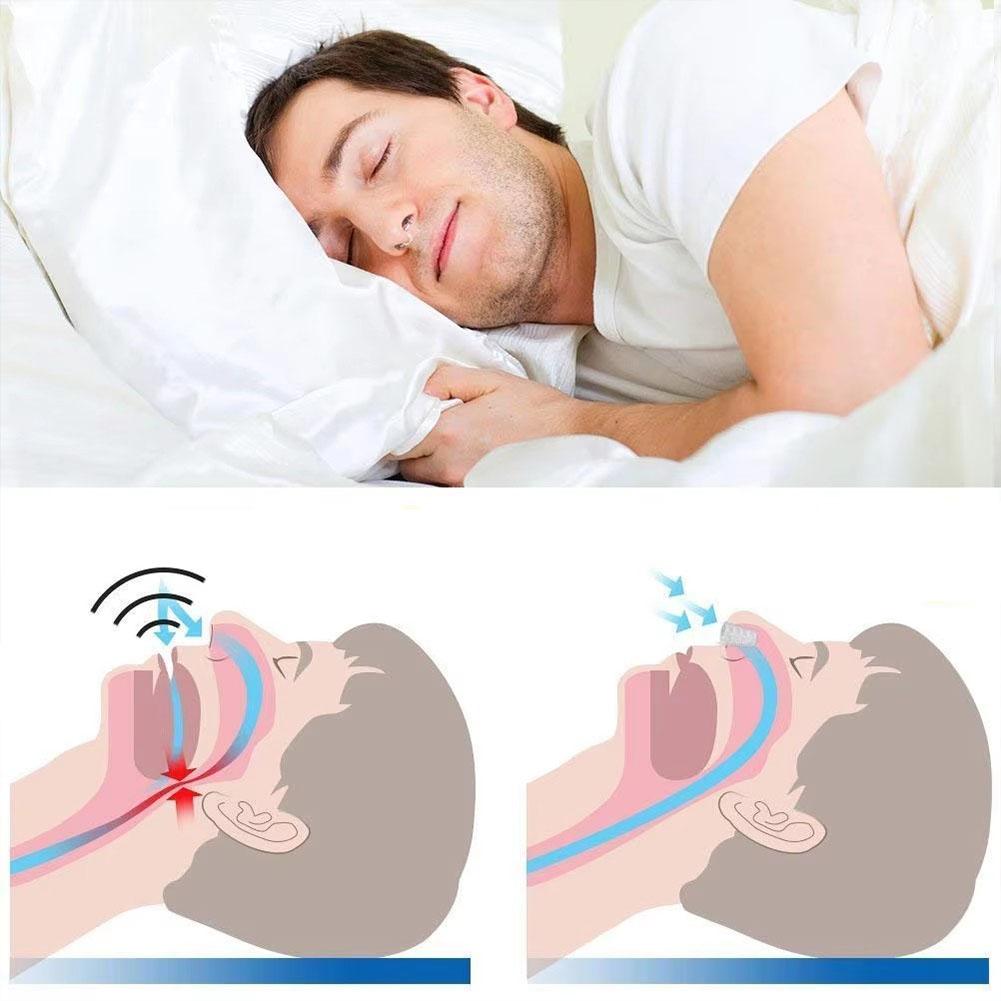Anti-Snoring Mouthpiece Adjustable Mouth Guard for Women Men Snore Reducing Comfortable Oral Appliance Snoring Relief Device