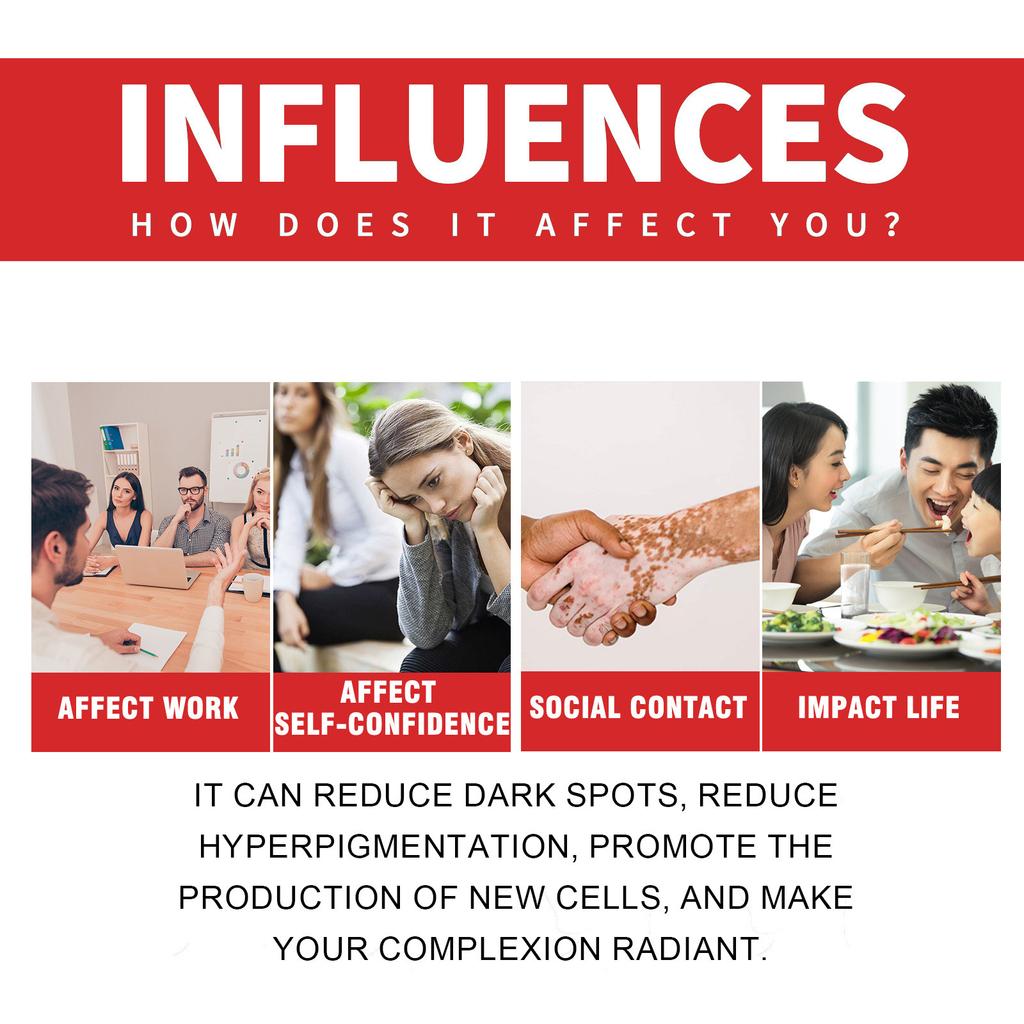 Whitening Face Cream, Whitening Cream, Facial Skin Moisturizing Brightening Cream,Natural Herbal Extract