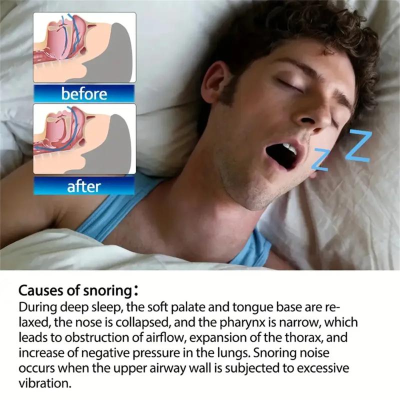 50pcs Snoring Stickers Breathing Nose Strips Physical Airway Expansion for Improved Nose Vent Anti-Snoring Comfort Sleep Aid