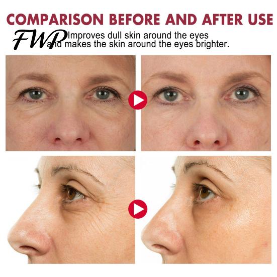 Reduce Fine Lines Eye Cream EELHOE Retinol Stick Renewing & Firming Under Balm for Dark Moisturizer Circles, Puffiness, Wrinkles Travel Essentials