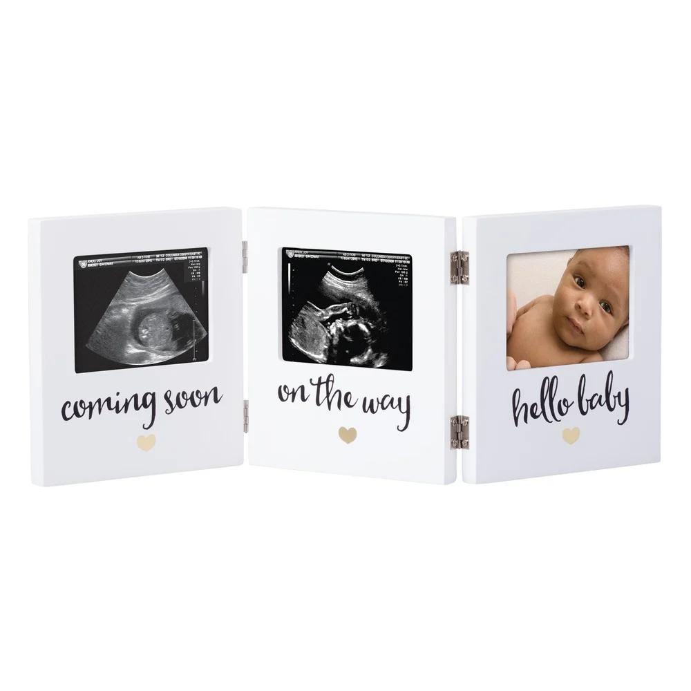 Triple Sonogram Keepsake Baby Picture Frame White Hinged Display Ultrasound Pregnancy Journey Ideal Gift Expecting Parents 3