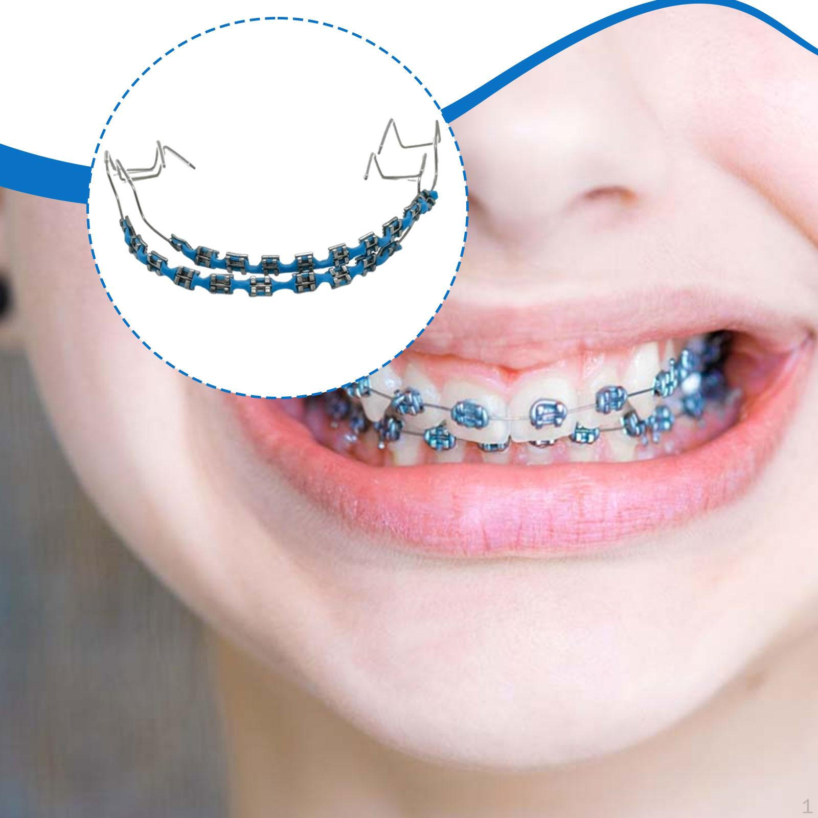

Temporary Tooth Decoration Fashion Brace for Parties Adults Music Festival синій