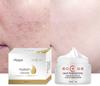 Best Quality Whitening Cream Dark Spot Remover Cream Face Pigment Melasma and Freckles Removal Cream