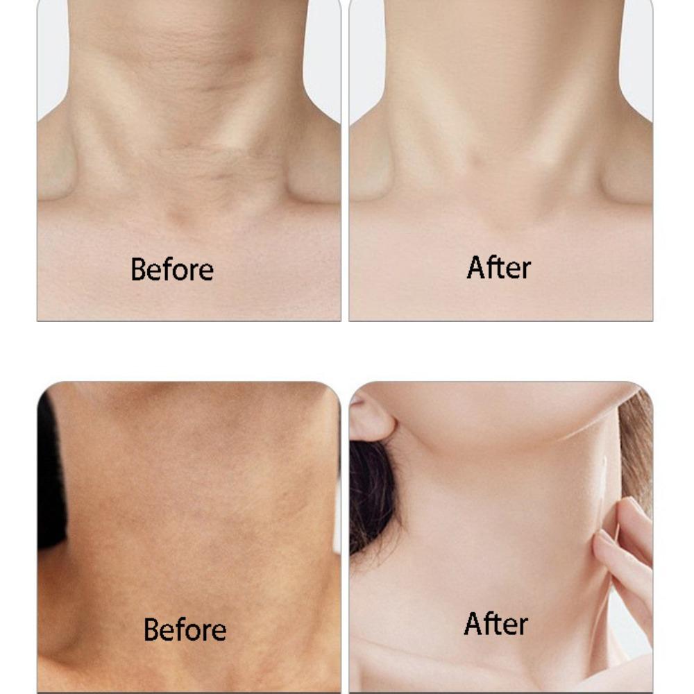 Gel Neck Mask Neck and Chin Lifting Anti-aging, Reduce Wrinkle, Dark Spots, and Fine Lines