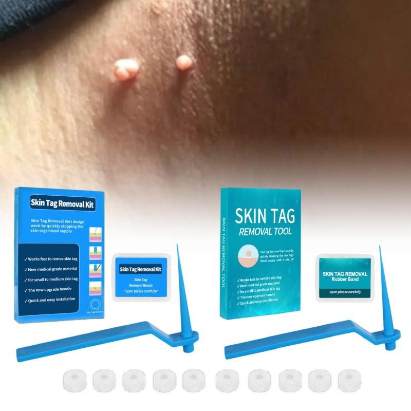 Effective Skin Tag Removal Tag Refill Band Set With 10 Pieces For Smooth Skin