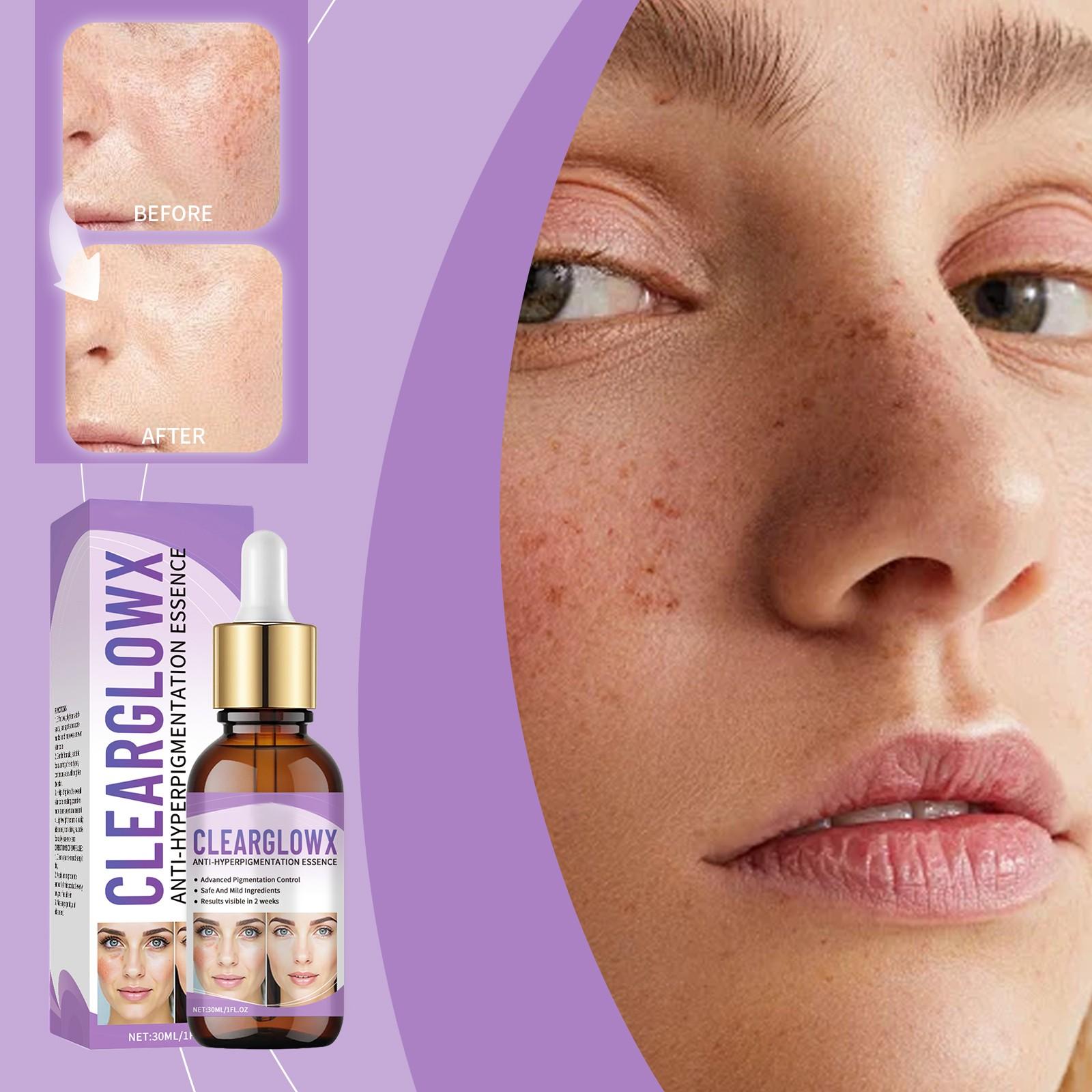 

-removing And Brightening Reduces Wrinkles, Moisturizes, Balances Water And Oil, Brightens, Moisturizes, Refines Pores, Shrinks Pores, Refines S30ML One Size
