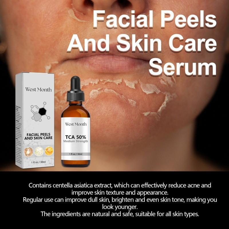 West Month Anti-acne Repair Serum For Diminishing Dark Spots And Cleansing Skin Imperfections