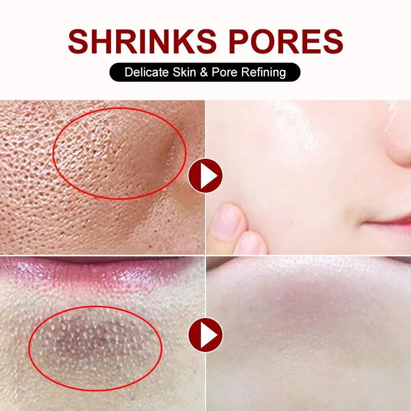 Crema restringente i pori all'acido salicilico Eliminazione rapida Pori dilatati Rimuovi i punti neri Stringi il prodotto per la cura della pelle liscia del viso