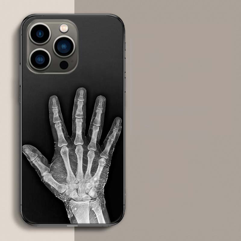 Herbst Röntgen Handknochen Handyhülle Für Apple Iphone 16E 16 17 Pro Max Air 15 Pro 14 Plus 12 13 Mini Hülle Niedliche Fundas Silico