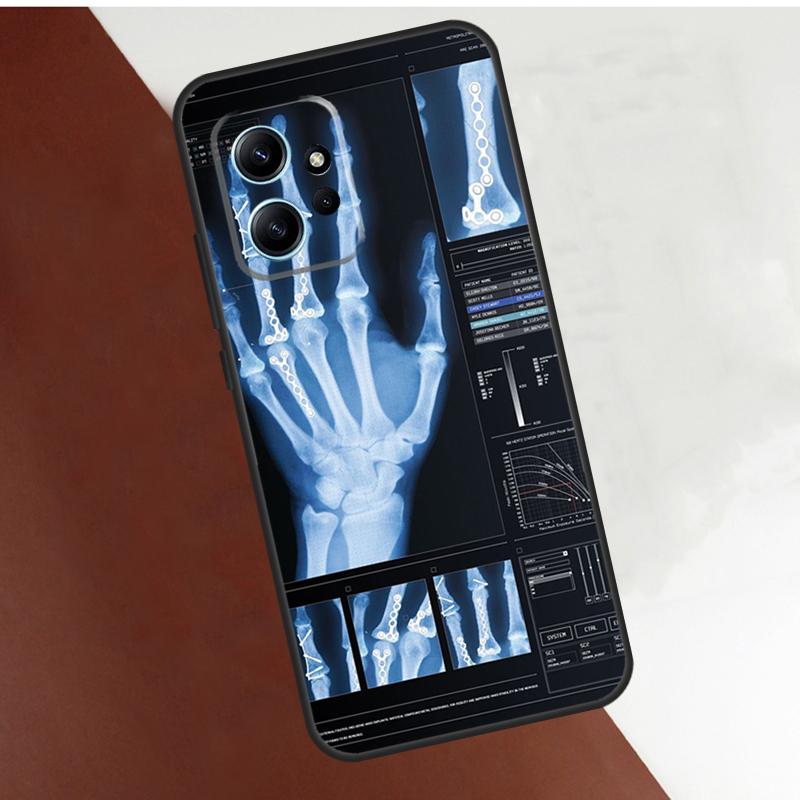 

Radiological Human Organs Skeleton Case For Xiaomi Redmi Note 12 11 10 8 9 Pro 12S 11S 10S 9S Coque For Redmi 12 9C 10C 12C Redmi Note 8 Pro