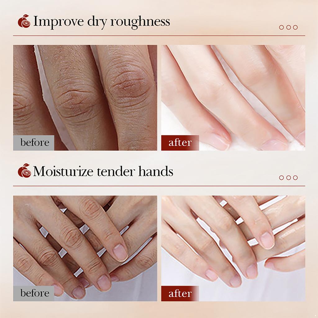 Travel-Size Hand Lotion Gift Set of 5, Moisturizing Cream with Fruity Floral Scents, Nourishing Care for Dry Cracked Hands in Winter