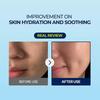 Torriden Dive-In Hyaluronic Acid Sheet Mask (10pcs) - Korean 5D Moisturizing Facial Mask with Panthenol & Allantoin, Korean Face Mask