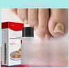 South Moon Nail Care Serum For Thick Yellow Nails Nourishing And Restorative Formula