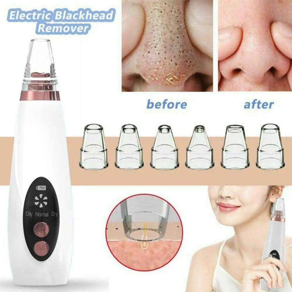 USB Rechargeable Blackhead Remover Electric Tool Blackhead Vacuum Cleaner  Acne Treatment