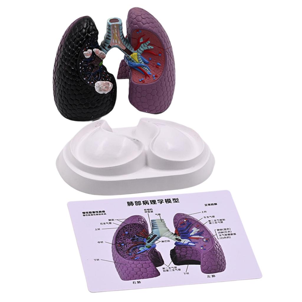 Anatomical Pathological Lung Model Human Lung Anatomy Model Normal and Pathological Lung Anatomy Model for Teaching Tool