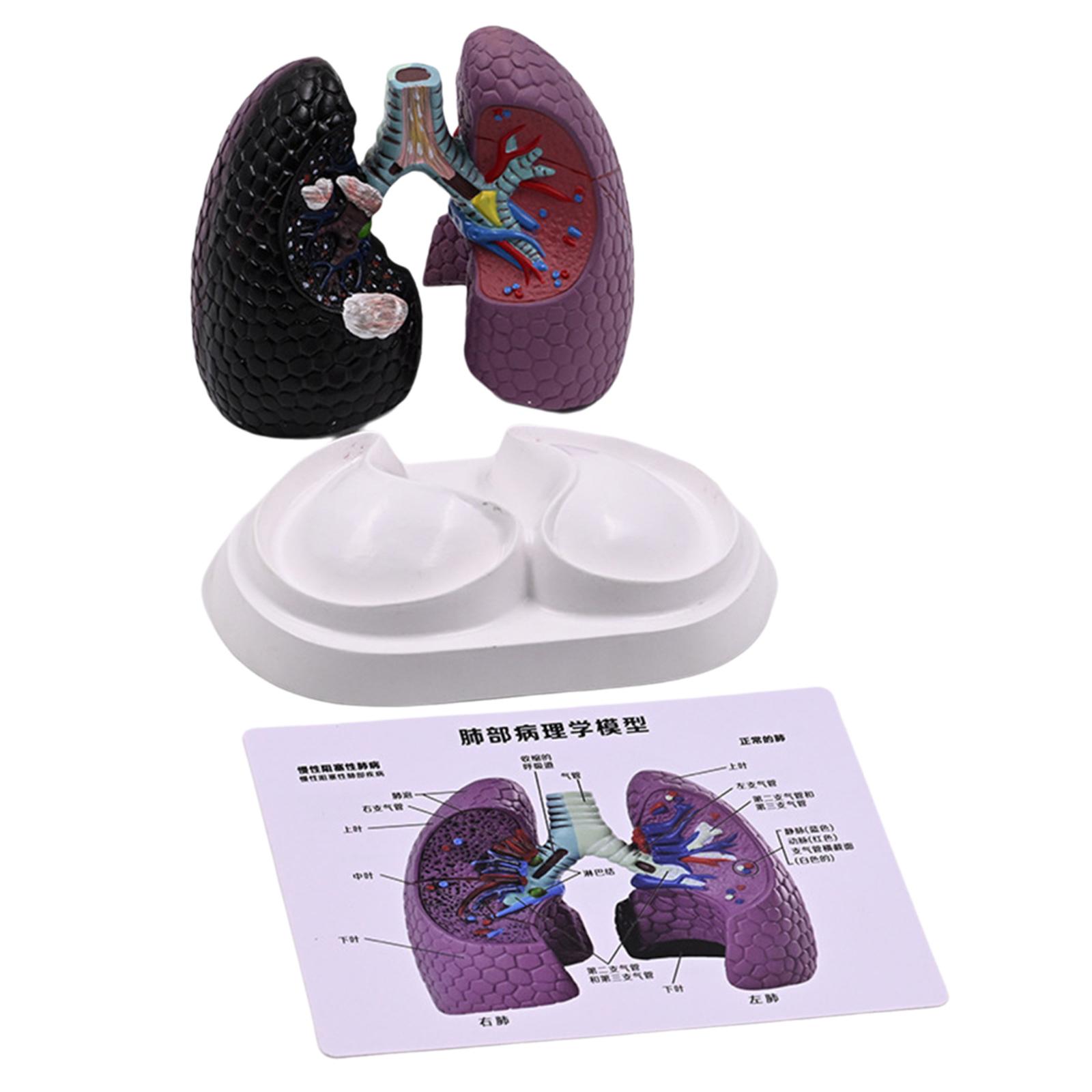 Anatomical Pathological Lung Model Human Lung Anatomy Model Normal and Pathological Lung Anatomy Model for Teaching Tool