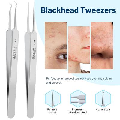 Mitesserentferner Pinzette, Eingewachsene Haare Pinzette, Präzisions Mitesser Pickel Entferner, Zellklemmen Pinzette, Pinzette für Frauen