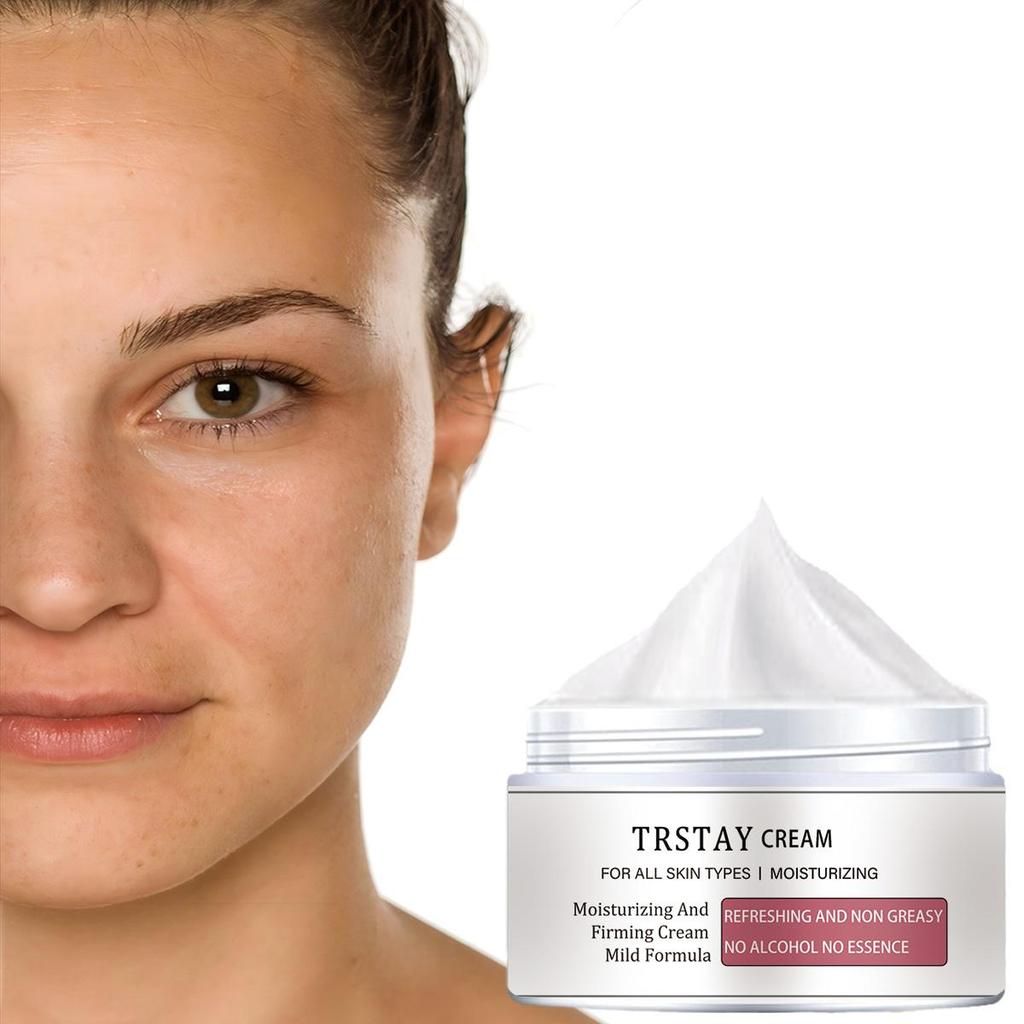 Sun spots chloasma arbutin anti-aging brightening skin whitening cream crema para manchas de la cara anti aging face cream