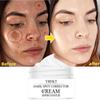 Cream, Dark Spot Corrector, Anti-aging, Whitening, Moisturizing, Removing Sunburn, Spots and Acne Pigmentation.